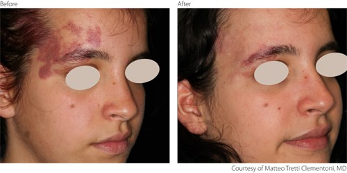 Before and after treatment photos