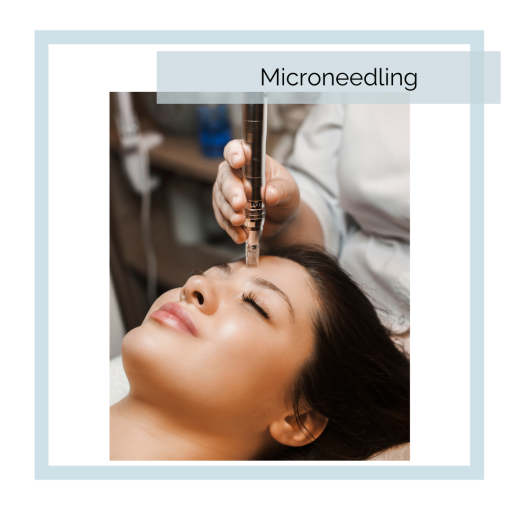 Microneedling at Abbracci Medical Spa