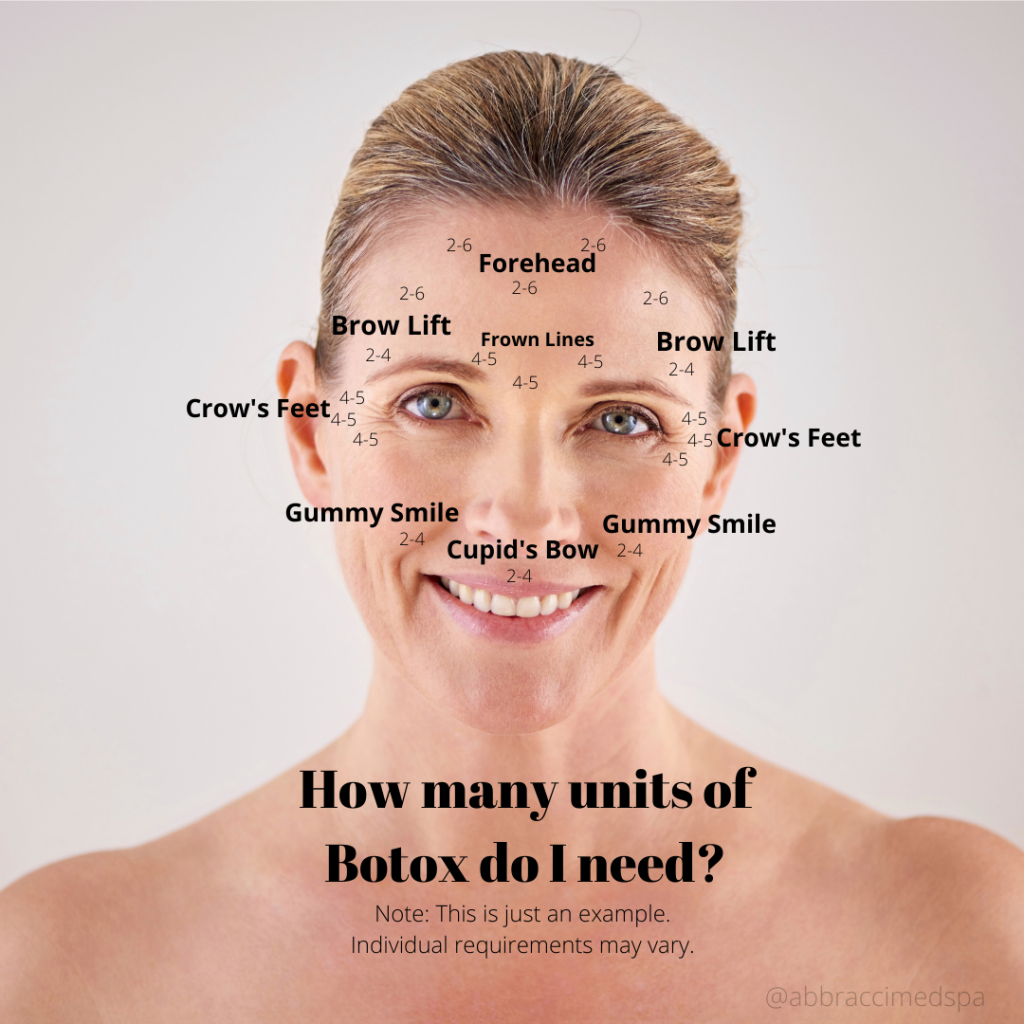 How Much Botox do I need?