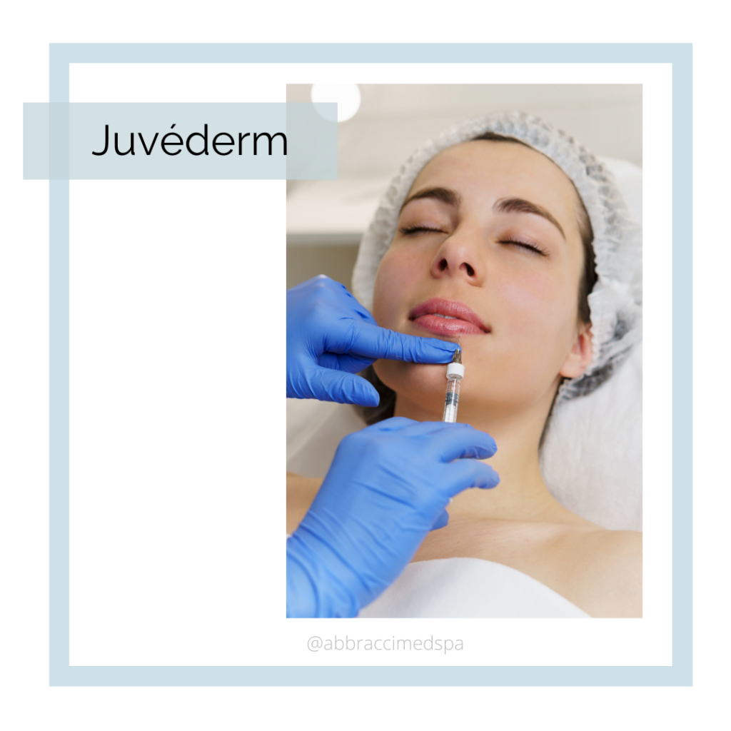 Juvederm at Abbracci Medical Spa