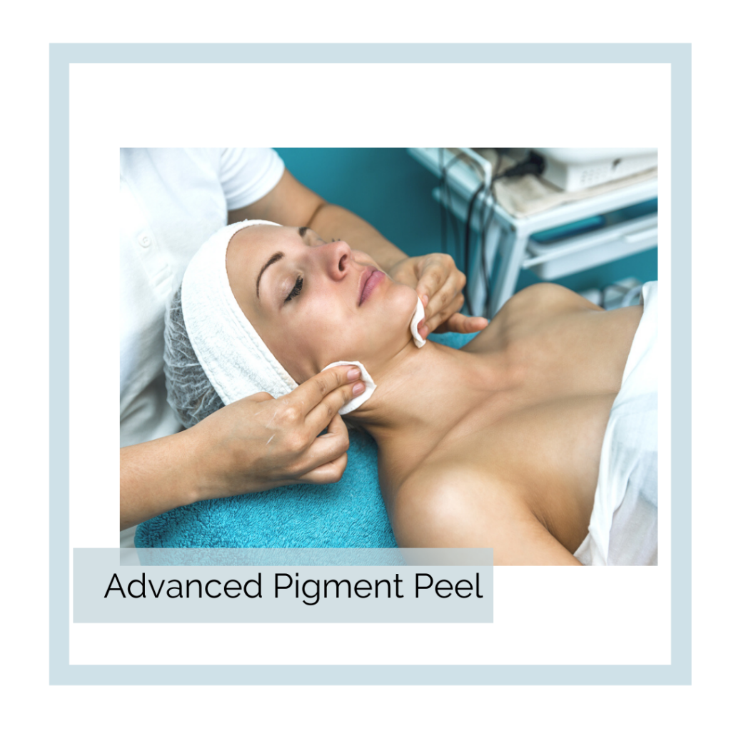 Advanced Pigment Peel at Abbracci Medical Spa