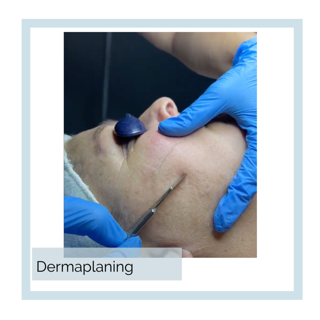 Abbracci Medical Spa Dermaplaning