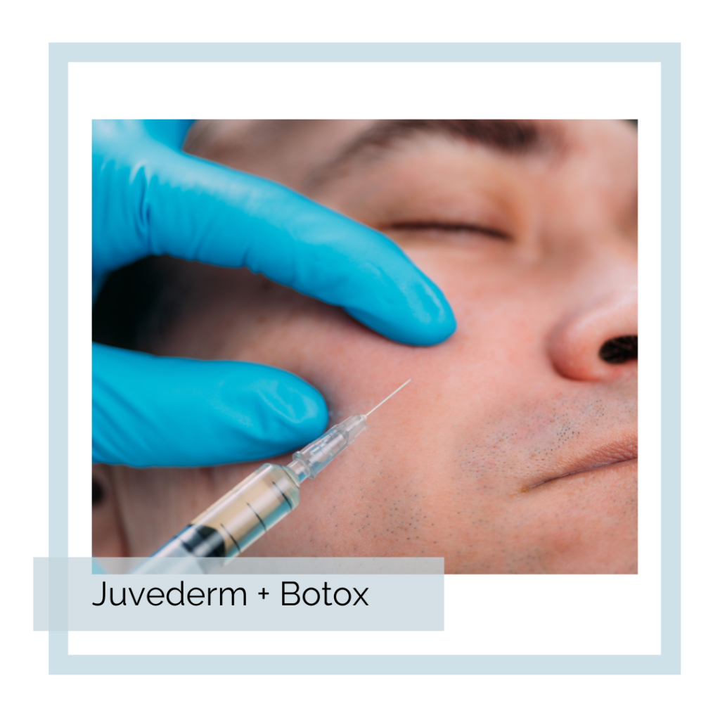 Juvederm at Abbracci Medical Spa