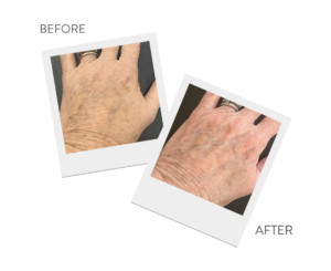 March Specials at Abbracci Medical Spa