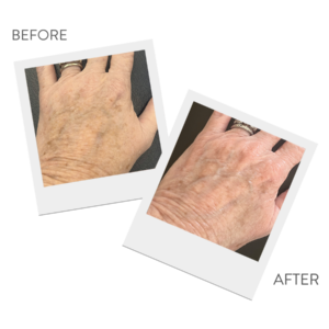 March Specials at Abbracci Medical Spa